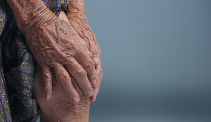 Rheumatoid Arthritis