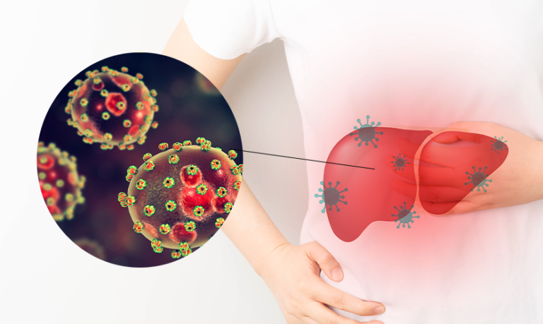 Viral Hepatitis