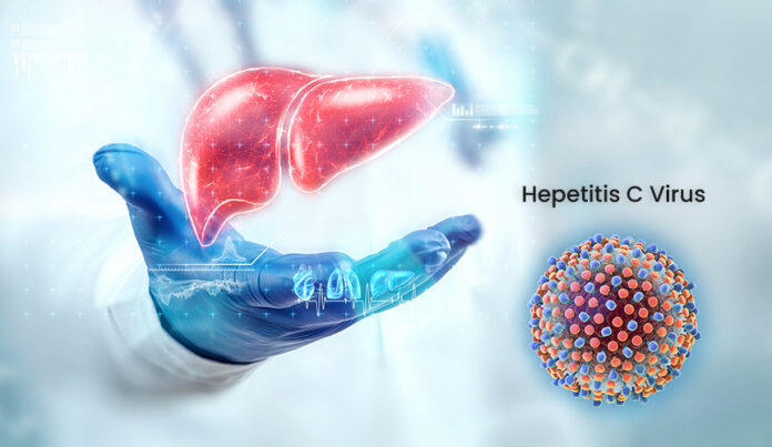 Hepatitis C